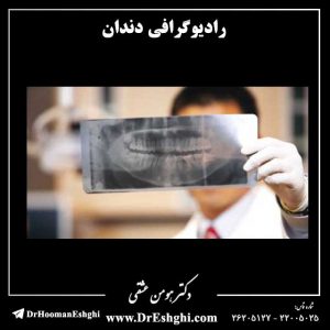 رادیوگرافی دندان