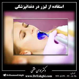 استفاده از لیزر در دندانپزشکی
