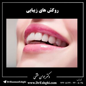 روکش-های-زیبایی