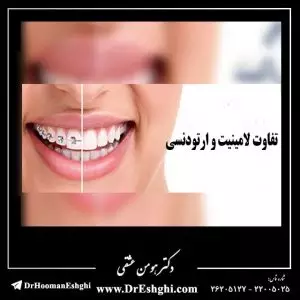 تفاوت لامینیت و ارتودنسی