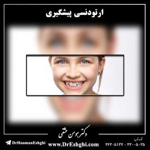 ارتودنسی پیشگیری