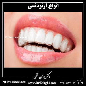 انواع ارتودنسی