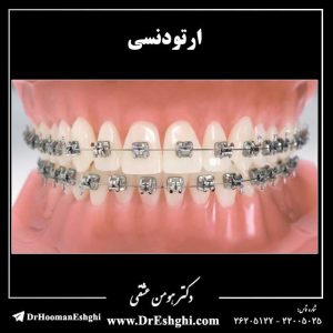ارتودنسی