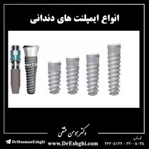 انواع ایمپلنت های دندانی