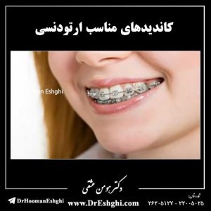 کاندیدهای مناسب ارتودنسی