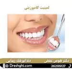 لمینیت کامپوزیتی