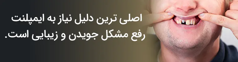 دلایل نیاز به ایمپلنت