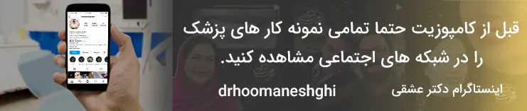 نمونه کار کامپوزیت