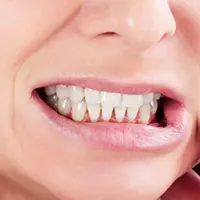 دندان قروچه