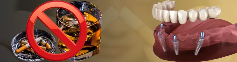 اقدامات قبل از ایمپلنت دندان