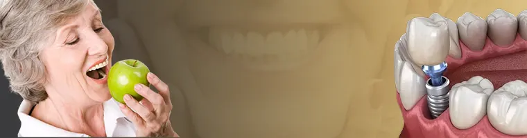 تغذیه بعد از ایمپلنت دندان