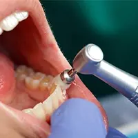 تمیز کردن دندان در بارداری