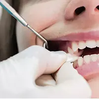 خونریزی بعد از ایمپلنت دندان