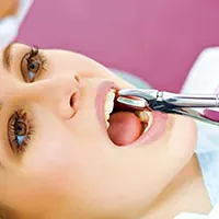 کشیدن دندان در بارداری