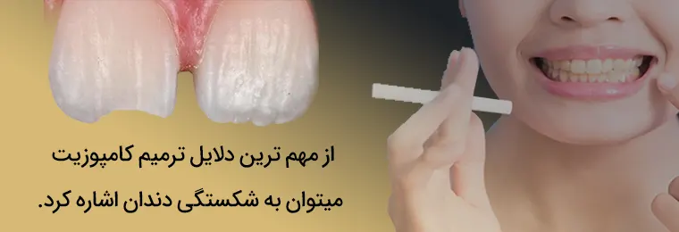 ترمیم کامپوزیت دندان