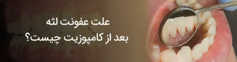 دلایل عفونت لثه