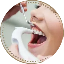 جراحی لثه