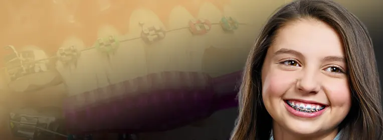 اصلاح فاصله بین دندان ها با ارتودنسی