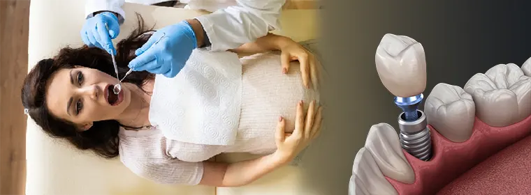 ایمپلنت دندان در بارداری