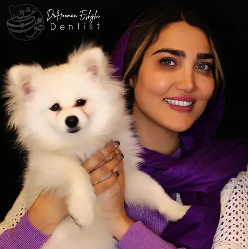 کامپوزیت دندان دکتر هومن عشقی