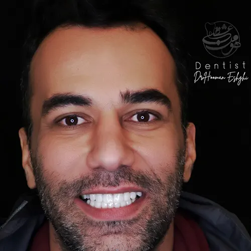 کامپوزیت