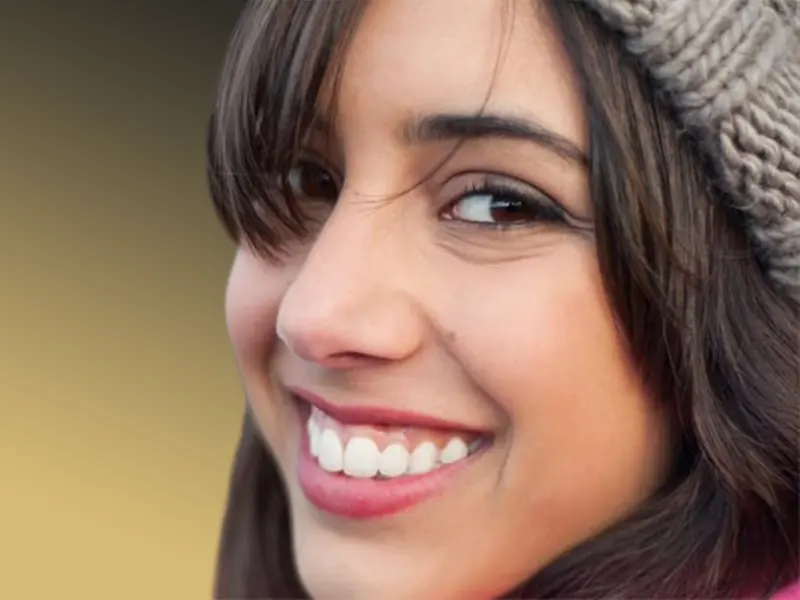 اصلاح لبخند لثه ای