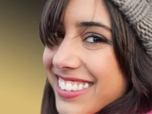 اصلاح لبخند لثه ای