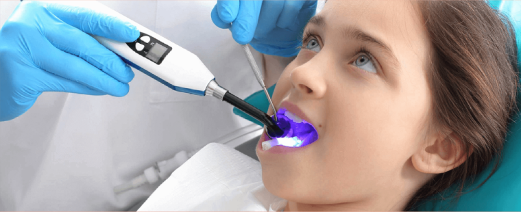 فیشورسیلانت تراپی در کودکان