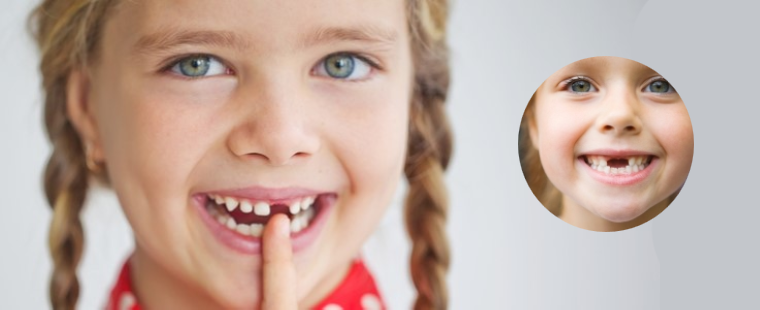 درمان درد دندان کودکان