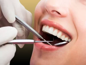 تفاوت بلیچینگ و جرم گیری