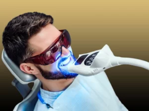 مراقبت های بعد از بلیچینگ دندان