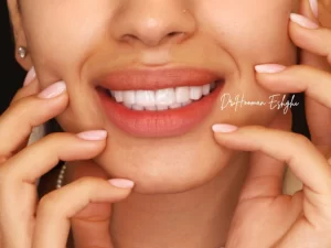 کامپوزیت دندان بدون تراش