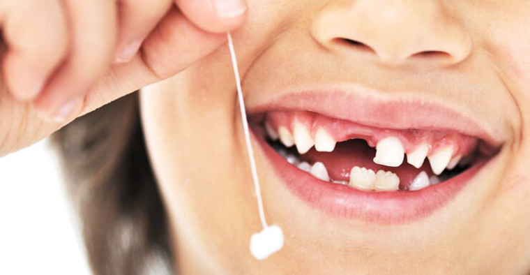 افتادن دندان شیری کودکان