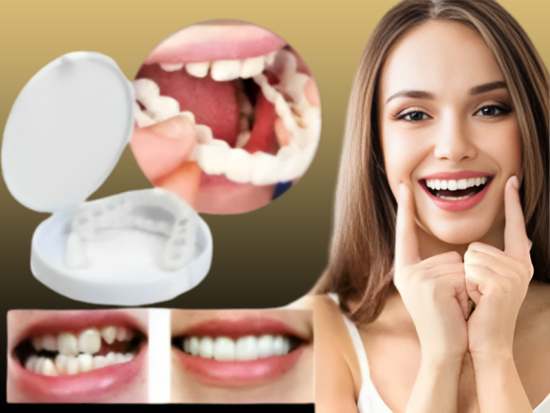 لمینت متحرک دندان