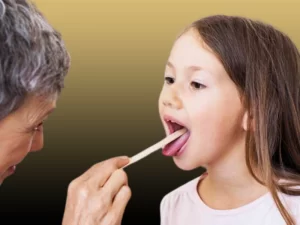 بوی بد دهان کودکان