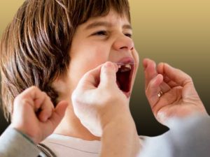 لق شدن دندان کودکان