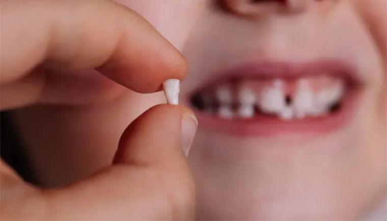 دیر افتادن دندان شیری