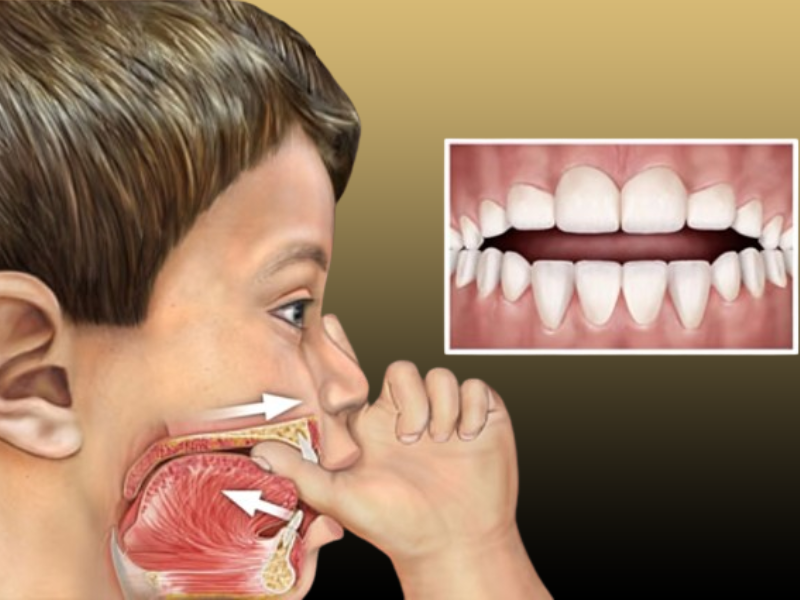 ناهنجاری های دندان