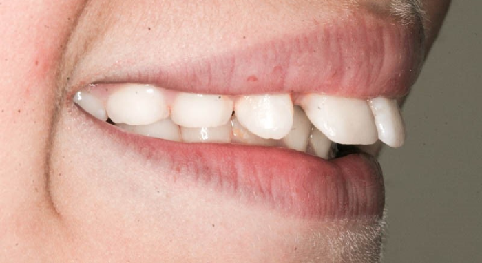 ناهنجاری های دندان