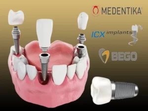 بهترین برند ایمپلنت